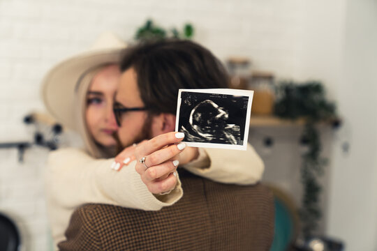 Young married Caucasian couple hugging woman showing an ultrasound image to the camera . High quality photo