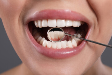 Examining woman's teeth with dentist's mirror on grey background, closeup