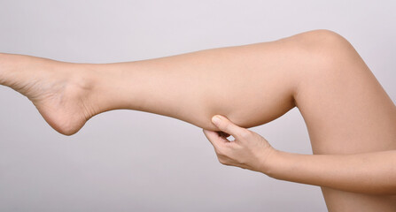 Calf fat, Fat woman pinching thigh leg skin, Overweight body test.