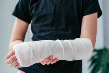 Close-up of a broken arm of a child in a cast. The girl holds her hand bent on the background of a...