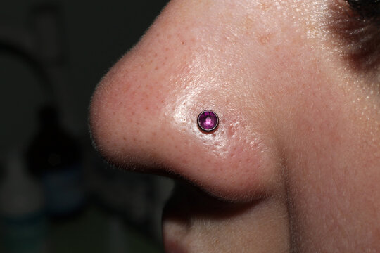 Girl's nose piercing.
Purple crystal.