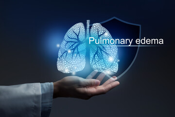 Medical banner Pulmonary edema on blue background with large copy space for text or checklist.