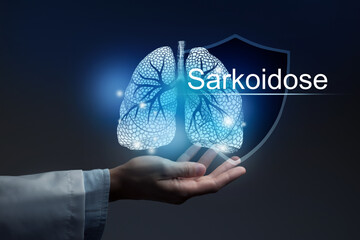 Medical banner Sarcoidosis with german translation Sarkoidose on blue background with large copy...