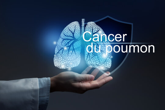 Medical banner Carcinoma with french translation Cancer du poumon on blue background with  large copy space for text or checklist.
