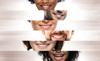 Close-up male and female smiles of different ethnicity people