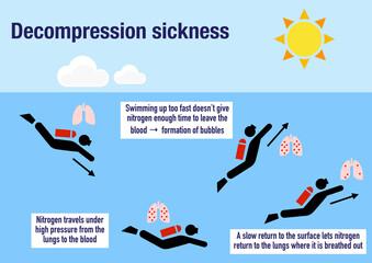 Infographic explaining the decompression sickness or divers disease - obrazy, fototapety, plakaty