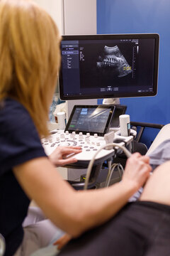 Clinician receiving ultrasound scan of fetus 