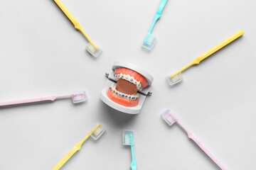 Model of jaw with dental braces and toothbrushes on light background