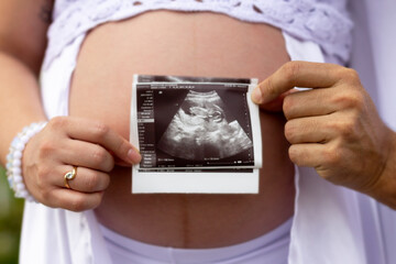 
pregnant with baby ultrasound