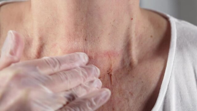 Closeup of lower face of person holding hands wearing protective plastic gloves in front of their chin.