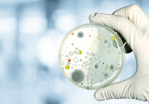 Backgrounds of Characteristics and Different shaped Colony of Bacteria and Mold growing on plates
