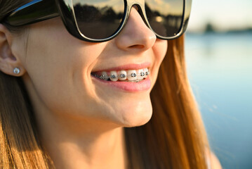 Joyful female with orthodontic brackets on teeth standing on the street. Concept of dentistry.	