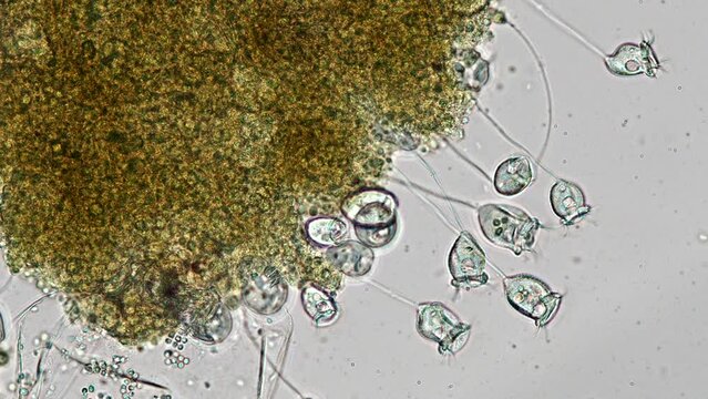 vorticella in aquarium water under the microscope - genus of bell-shaped ciliates (protozoa)