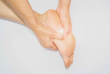 Foot posture of a woman with muscle symptom.
