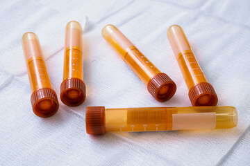 Plastic test tubes with caps for the collection of samples. Blood sampling tubes.
