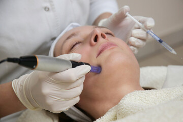 Mesotherapy. Woman having dermapen facial treatment.
Micro needle cosmetic treatment at...