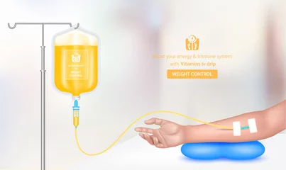 Fotobehang Intravenous vitamin iv drip treatment in spa salon, clinic. Serum collagen vitamin orange inside saline bag for weight control. Used for giving injections for health. Vector EPS 10. © Adisak