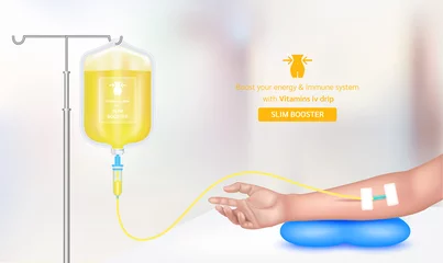Fotobehang Intravenous vitamin iv drip treatment in spa salon, clinic. Serum collagen vitamin yellow inside saline bag for slim booster. Used for giving injections for health. Vector EPS 10. © Adisak