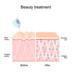 Beauty treatment. Human skin before and after procedure.