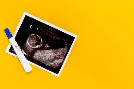 Positive pregnancy test with ultrasound picture of unborn baby