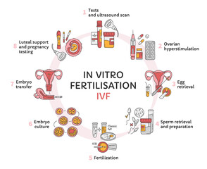 In Vitro fertilization IVF vector circle infographic, infertility treatment scheme. Ovarian hyperstimulation, artificial insemination, embryo culture, luteal support. Medical procedure for pregnancy - obrazy, fototapety, plakaty