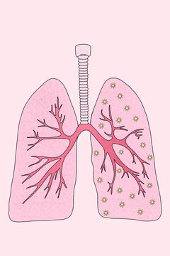 Picture of human lungs with coronavirus
