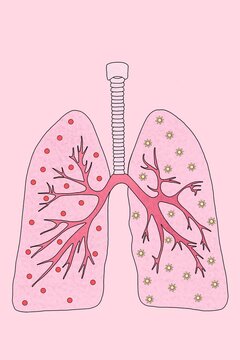 Picture of human lungs with coronavirus
