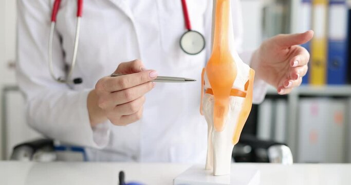 Doctor shows anterior and posterior cruciate ligaments and patella model of leg