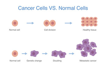 Compare between devenlop of healthy cell and cancer cell. Medical and science diagram about abnormal cells grow. - obrazy, fototapety, plakaty