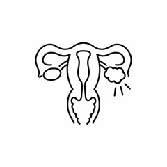 Polycystic ovary syndrome line color icon. Female reproductive system disease