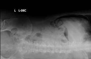Pneumoperitoneum. LLD abdominal x-ray 
