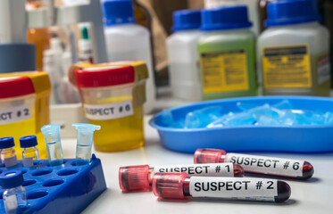 Various analyses of urine, saliva and blood of homicide suspects in crime lab, conceptual image. - obrazy, fototapety, plakaty