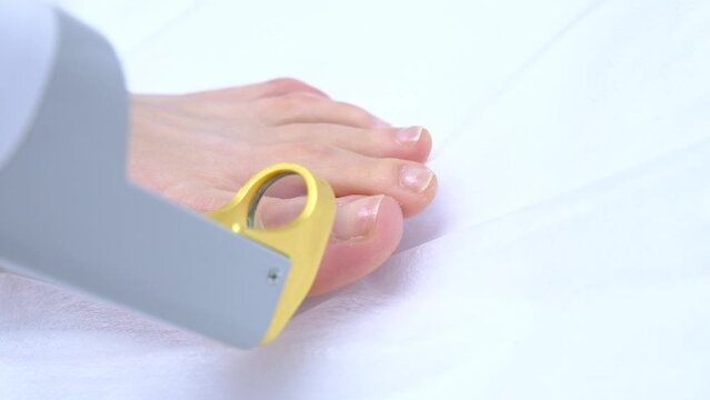 skin wart laser procedure in the clinic