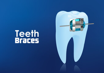 Orthodontic teeth or dental braces concept . illustration vector