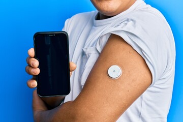 Hispanic man showing diabetes device on arm and holding smartphone with insuline control app