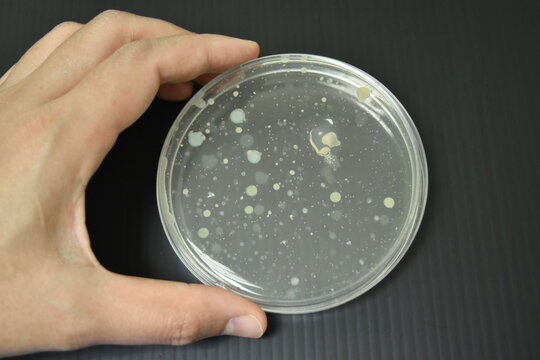 Colonies of bacteria growth on agar plate medium