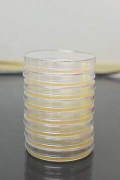 Petri dishes filled with agar growth medium. Medical science equipment.