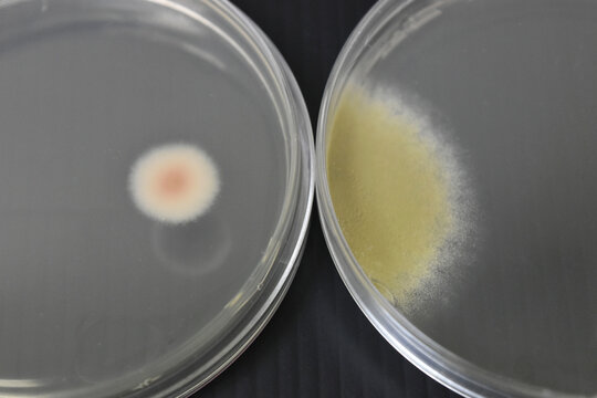 Colonies of bacteria growth on agar plate medium