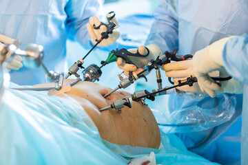 Hands of surgeons while manipulating instruments of laparoscopic surgery