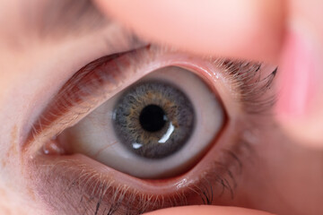 Augen Untersuchung Augenarzt Nahaufnahme