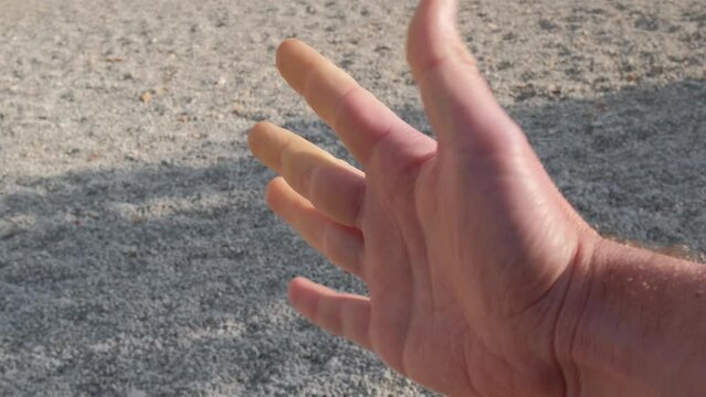 Hands of a person with Raynaud syndrome during an attack.