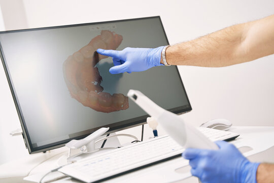 Male dentist hand pointing at computer display with dental 3D scan
