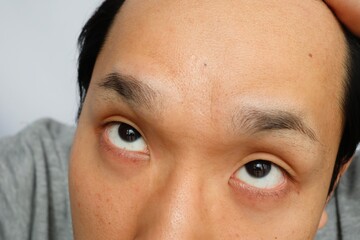 Fototapeta premium 日本人男性の額は広い