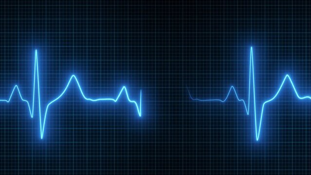 EKG. heart rate monitor. Heart beat pulse in blue - cardiology. Looped animation