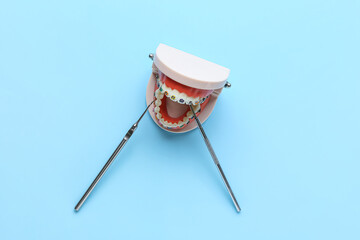 Model of jaw with dental braces and dentist tools on blue background