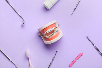 Model of jaw with dental braces and dentist tools on lilac background