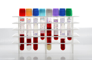 Test tubes in rack - blood tubes