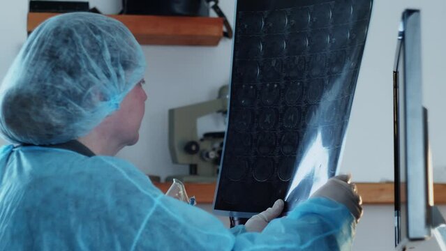 A female surgeon examines a medical history on an X-ray of a brain tumor in preparation for surgery. Neurosurgery.