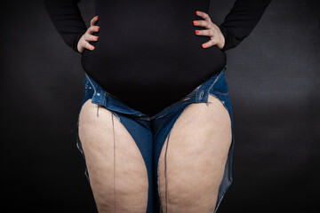 fat woman in ripped jeans on a black background