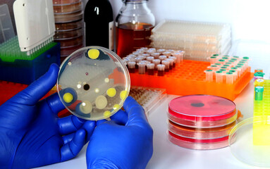 Inspection of a microbial culture plate in the research laboratory